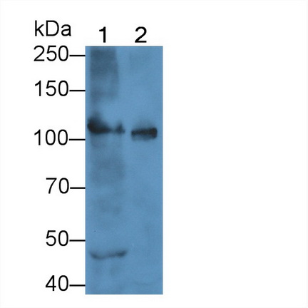 Polyclonal Antibody to Hexokinase 1 (HK1)