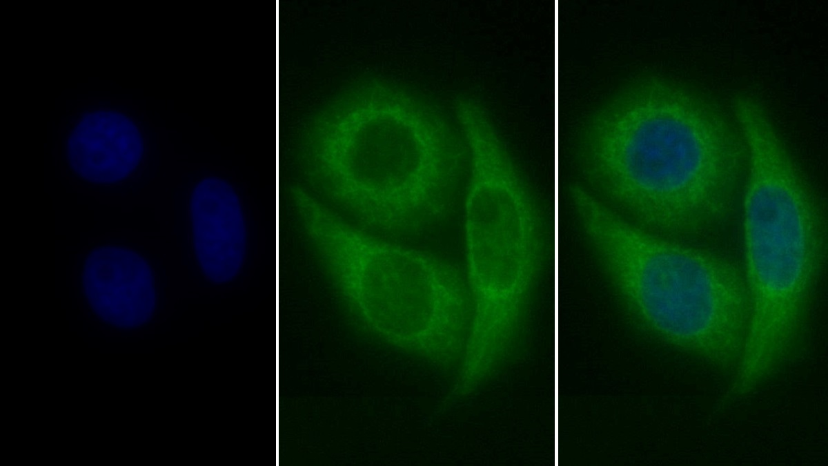 Polyclonal Antibody to Hexokinase 1 (HK1)