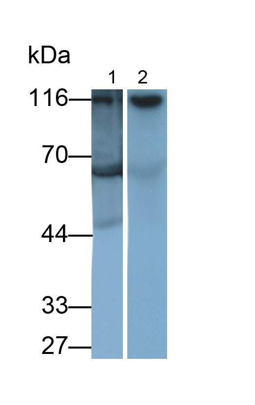 Polyclonal Antibody to Hexokinase 1 (HK1)