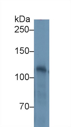 Polyclonal Antibody to Hexokinase 1 (HK1)