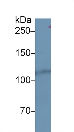 Polyclonal Antibody to Hexokinase 1 (HK1)