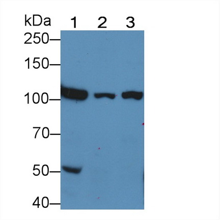 Polyclonal Antibody to Hexokinase 1 (HK1)