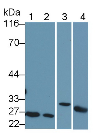 Polyclonal Antibody to B-Cell Leukemia/Lymphoma 2 (Bcl2)