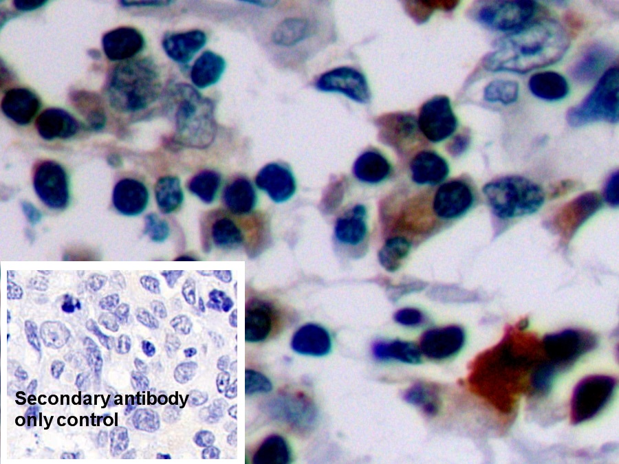 Polyclonal Antibody to B-Cell Leukemia/Lymphoma 2 (Bcl2)