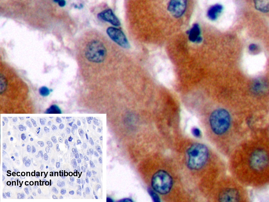 Polyclonal Antibody to B-Cell Leukemia/Lymphoma 2 (Bcl2)