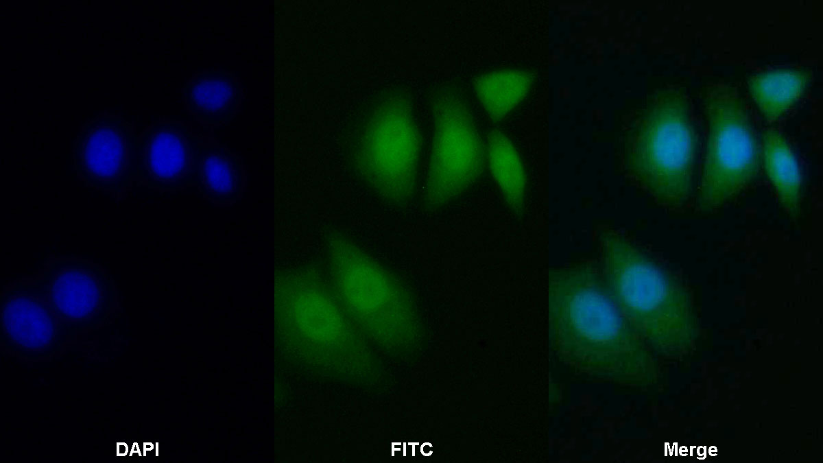 Polyclonal Antibody to B-Cell Leukemia/Lymphoma 2 (Bcl2)
