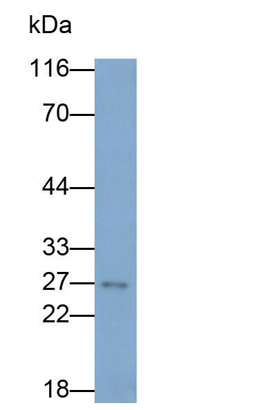 Polyclonal Antibody to B-Cell Leukemia/Lymphoma 2 (Bcl2)