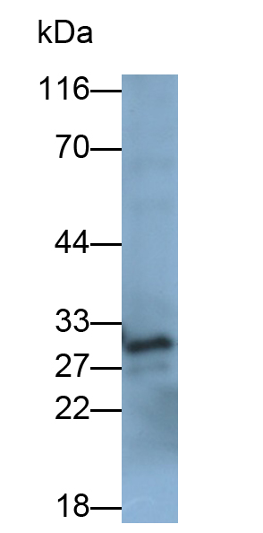 Polyclonal Antibody to B-Cell Leukemia/Lymphoma 2 (Bcl2)