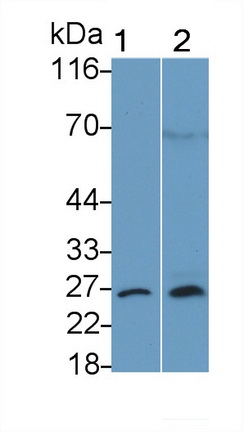 Polyclonal Antibody to B-Cell Leukemia/Lymphoma 2 (Bcl2)