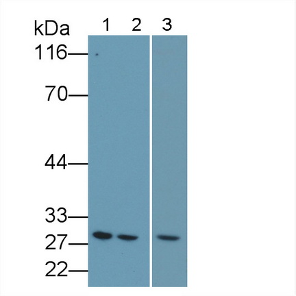 Polyclonal Antibody to B-Cell Leukemia/Lymphoma 2 (Bcl2)