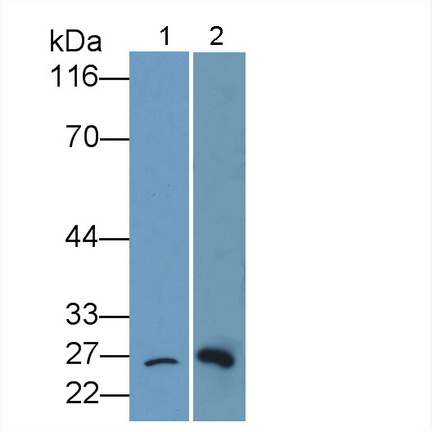 Polyclonal Antibody to B-Cell Leukemia/Lymphoma 2 (Bcl2)