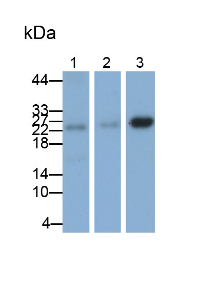 Polyclonal Antibody to B-Cell Leukemia/Lymphoma 2 (Bcl2)