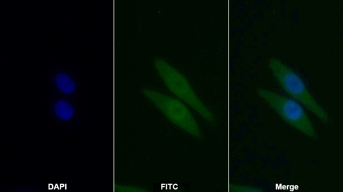 Polyclonal Antibody to B-Cell Leukemia/Lymphoma 2 (Bcl2)