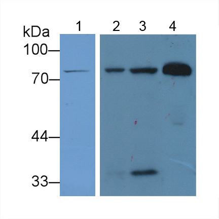 Polyclonal Antibody to Lactoferrin (LTF)