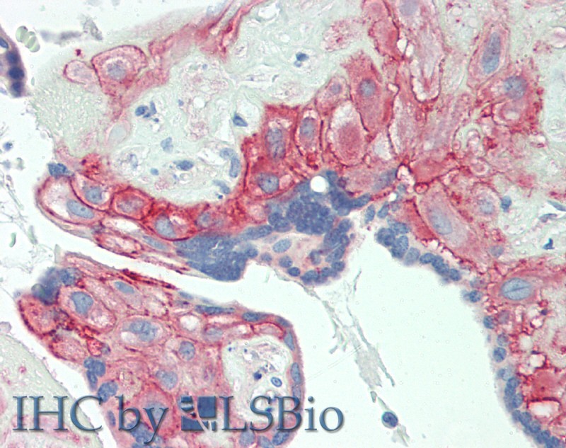 Polyclonal Antibody to Cluster Of Differentiation 276 (CD276)