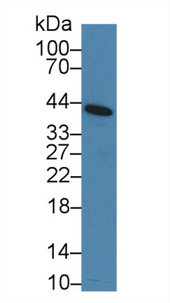 Polyclonal Antibody to Cluster Of Differentiation 276 (CD276)