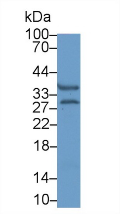 Polyclonal Antibody to Carbonic Anhydrase II (CA2)