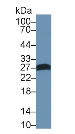 Polyclonal Antibody to Carbonic Anhydrase II (CA2)