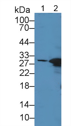 Polyclonal Antibody to Carbonic Anhydrase II (CA2)