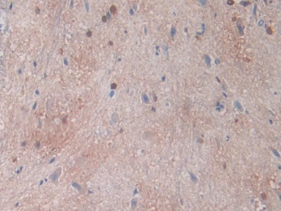 Polyclonal Antibody to Carbonic Anhydrase II (CA2)