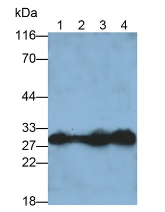 Polyclonal Antibody to Carbonic Anhydrase II (CA2)