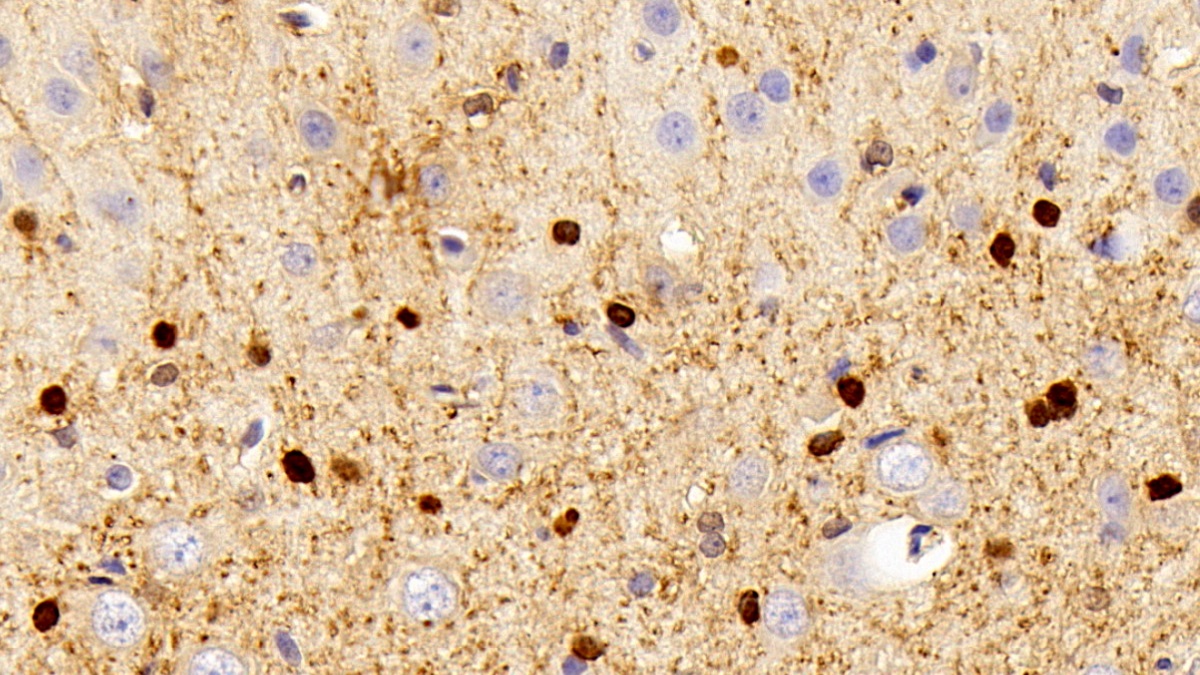 Polyclonal Antibody to Carbonic Anhydrase II (CA2)