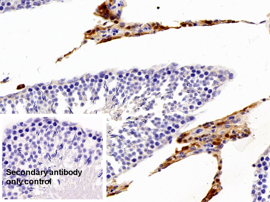 Polyclonal Antibody to Carbonic Anhydrase II (CA2)