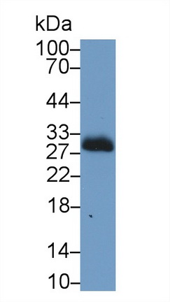 Polyclonal Antibody to Carbonic Anhydrase II (CA2)