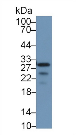 Polyclonal Antibody to Carbonic Anhydrase II (CA2)