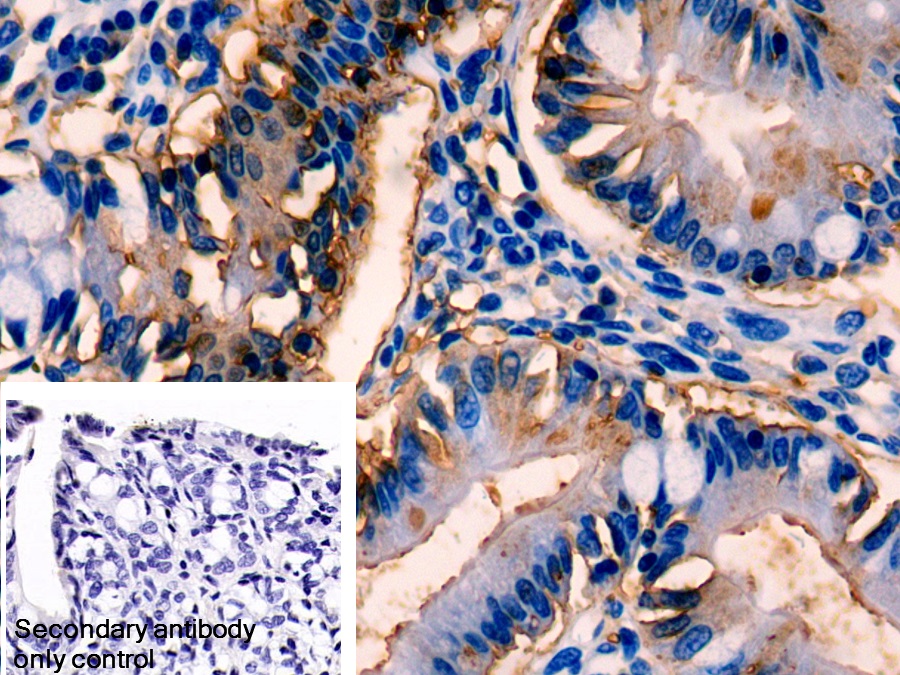 Polyclonal Antibody to Carbonic Anhydrase II (CA2)