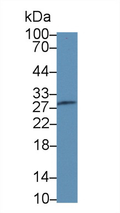 Polyclonal Antibody to Carbonic Anhydrase II (CA2)