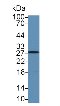 Polyclonal Antibody to Carbonic Anhydrase II (CA2)