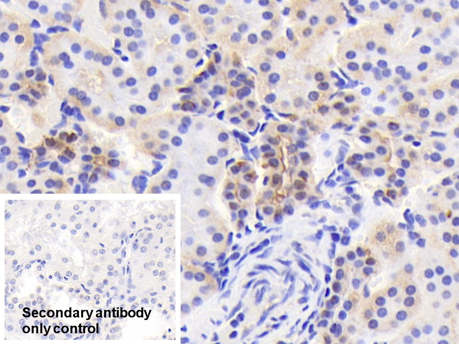 Polyclonal Antibody to Carbonic Anhydrase II (CA2)