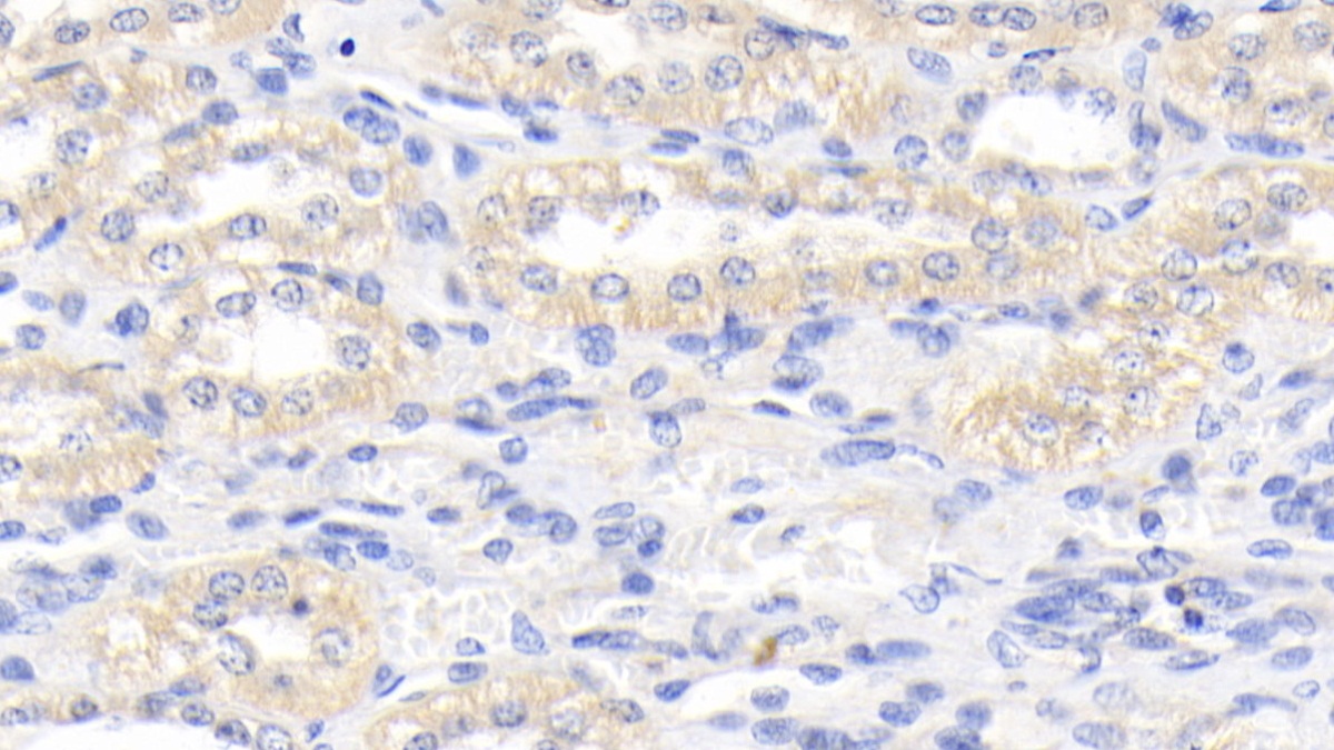 Polyclonal Antibody to Kidney Injury Molecule 1 (Kim1)