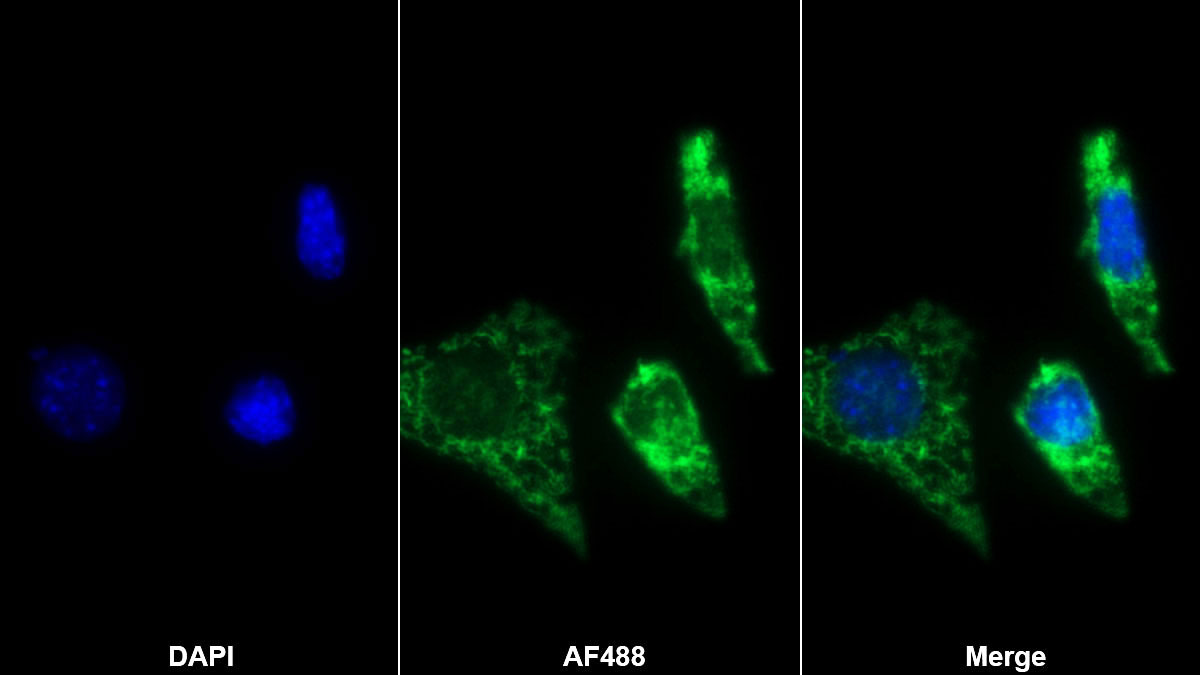 Polyclonal Antibody to Kidney Injury Molecule 1 (Kim1)