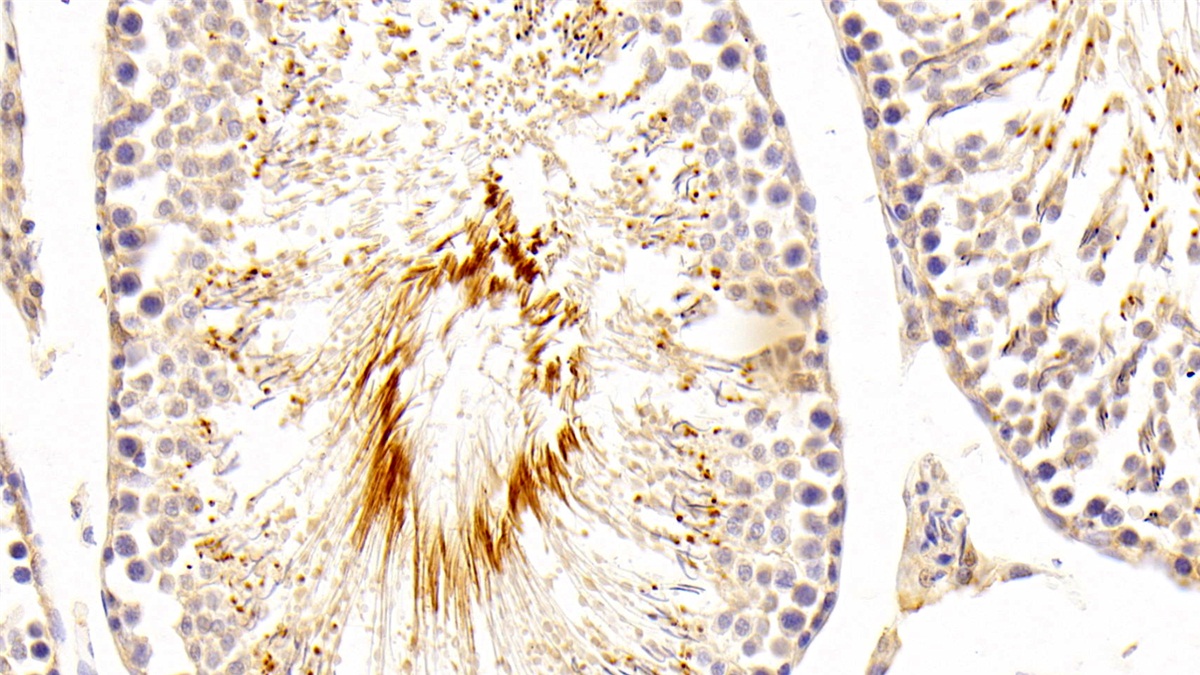 Polyclonal Antibody to Kidney Injury Molecule 1 (Kim1)