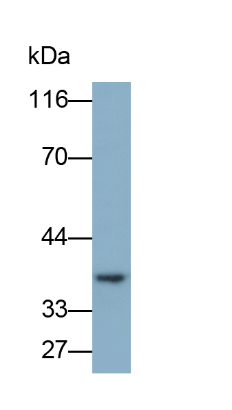 Polyclonal Antibody to Ficolin 1 (FCN1)