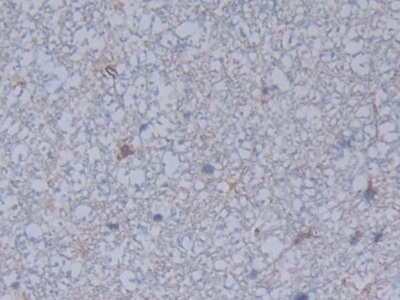 Polyclonal Antibody to Ficolin 1 (FCN1)