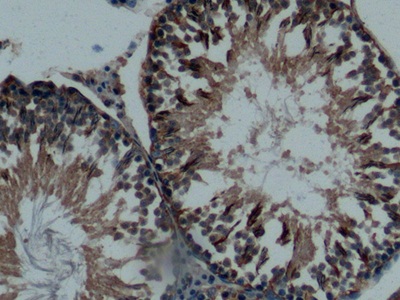 Polyclonal Antibody to Osteonectin (ON)