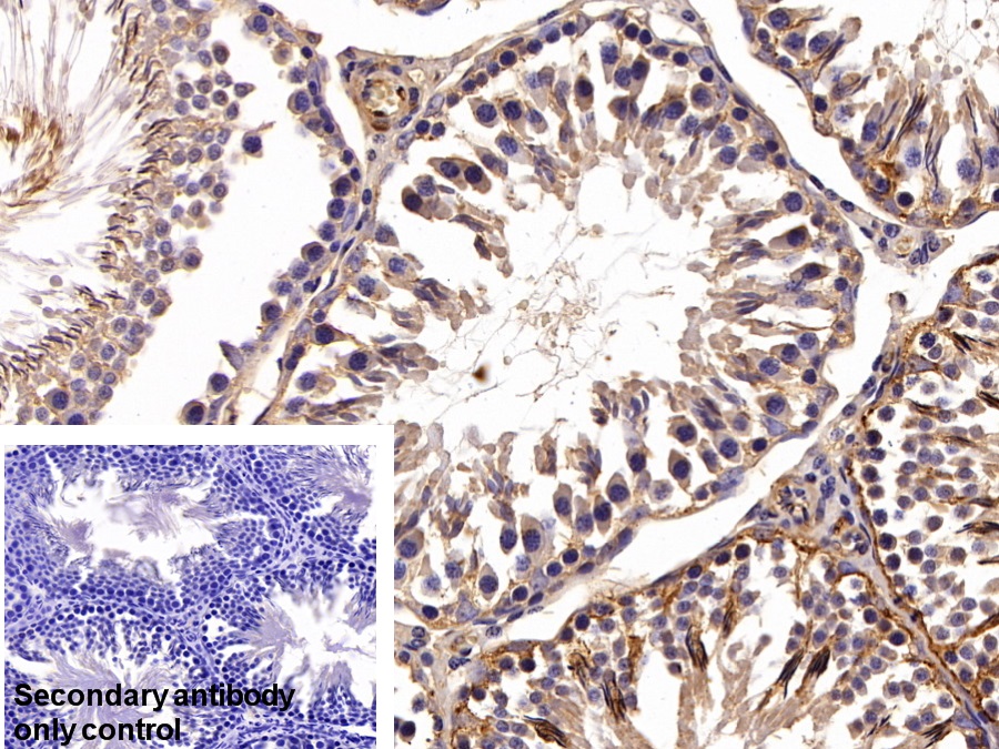 Polyclonal Antibody to Osteonectin (ON)