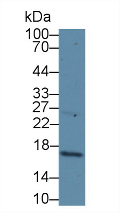 Polyclonal Antibody to Cyclin Dependent Kinase Inhibitor 2A (CDKN2A)