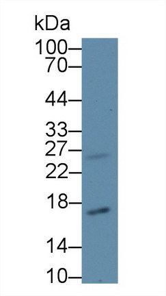 Polyclonal Antibody to Cyclin Dependent Kinase Inhibitor 2A (CDKN2A)