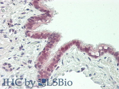 Polyclonal Antibody to Chemokine (C motif) ligand (XCL1)