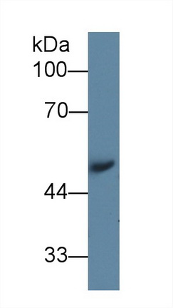 Polyclonal Antibody to Angiotensinogen (AGT)