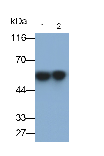 Polyclonal Antibody to Angiotensinogen (AGT)