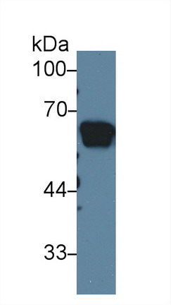 Polyclonal Antibody to Angiotensinogen (AGT)