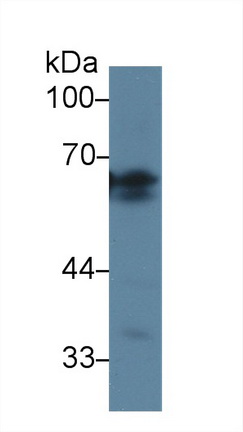 Polyclonal Antibody to Angiotensinogen (AGT)