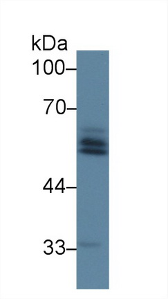 Polyclonal Antibody to Angiotensinogen (AGT)