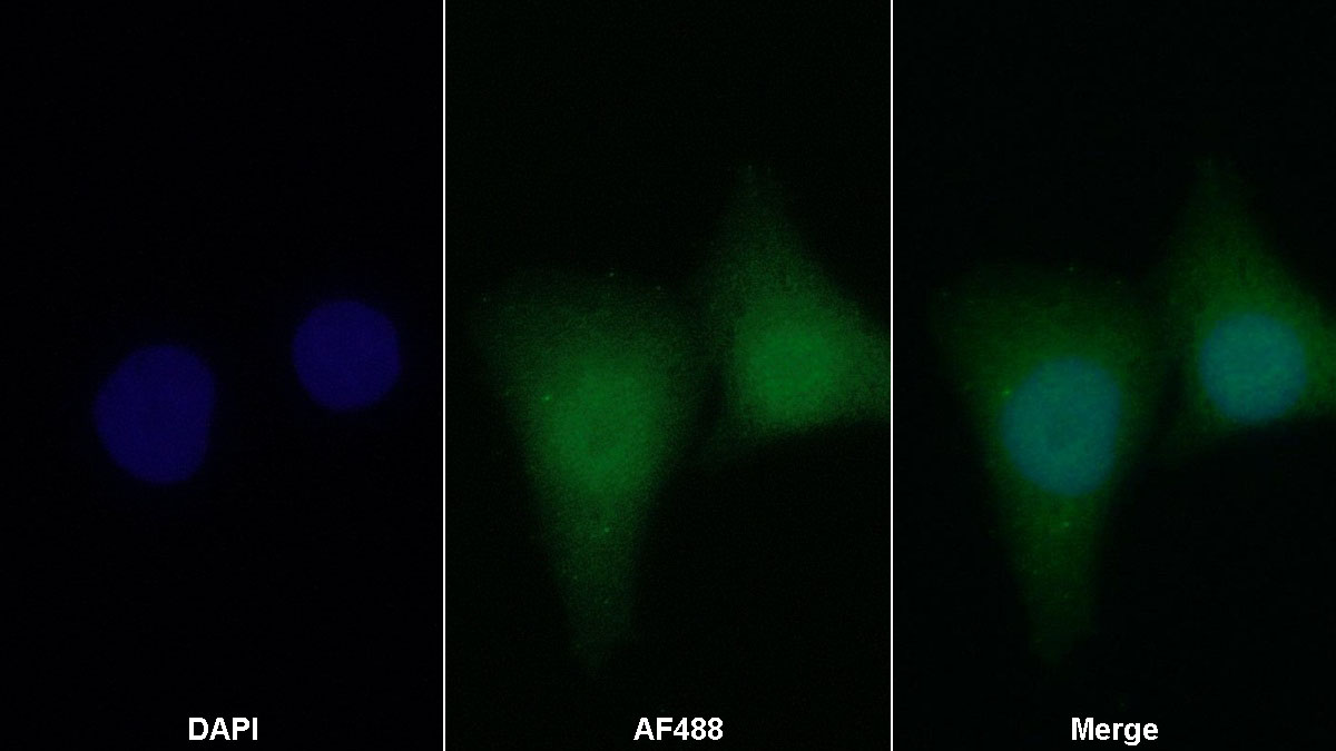 Polyclonal Antibody to Hypoxia Inducible Factor 1 Alpha (HIF1a)