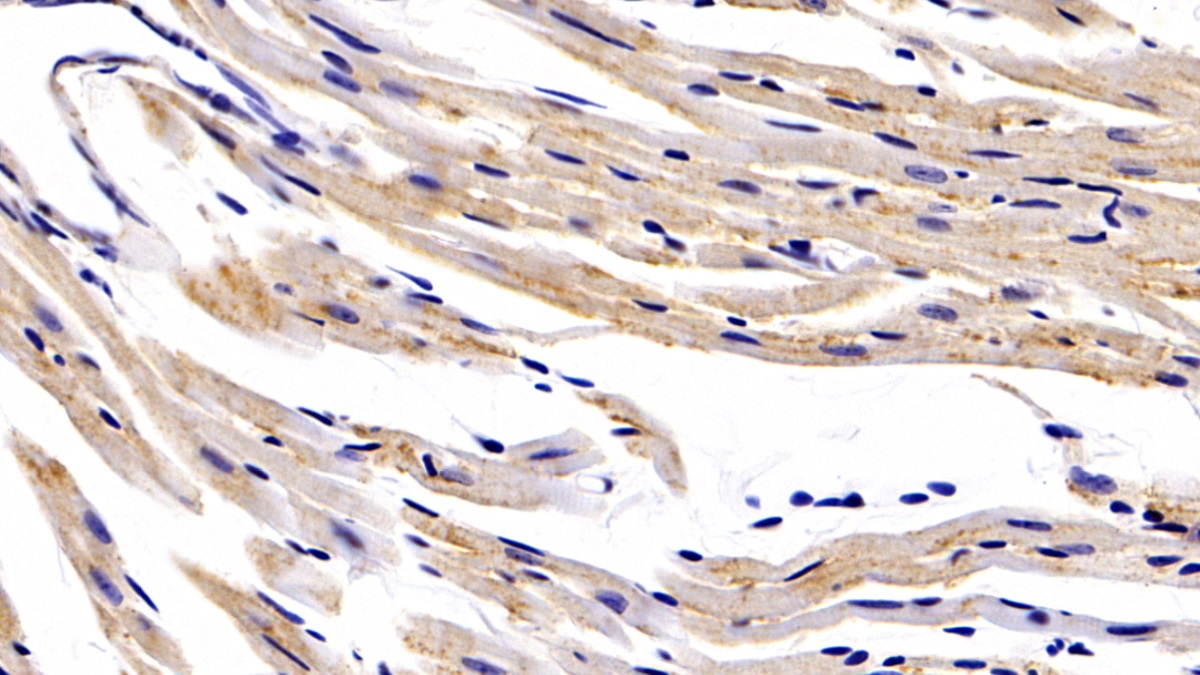 Polyclonal Antibody to Hypoxia Inducible Factor 1 Alpha (HIF1a)